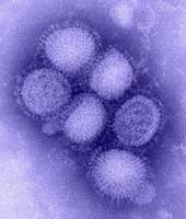 Swine Flu cases rise in Pimpri-Chinchwad, 31 reported in August