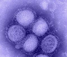 Swine Flu cases rise in Pimpri-Chinchwad, 31 reported in August