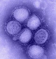 Swine Flu cases rise in Pimpri-Chinchwad, 31 reported in August